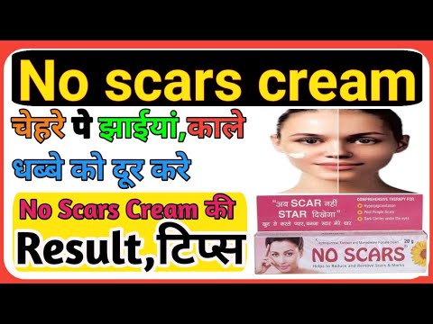 NO scars cream की खाश टिप्स l Special tips no scars cream, #cngajbhiye #noscarscream