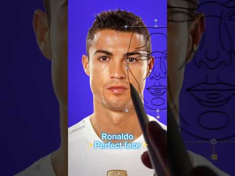 Ronaldo perfect face surgery!