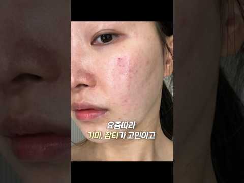 기미, 잡티에 효과본 스킨케어추천템..?! #skincare