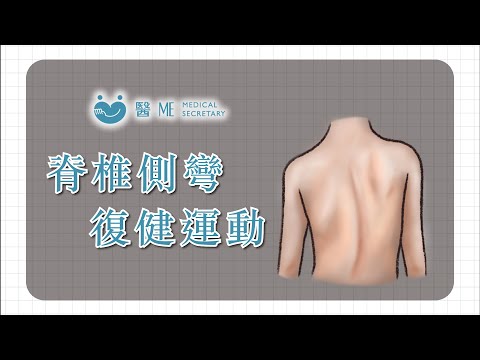 Scoliosis┃Rehabilitation