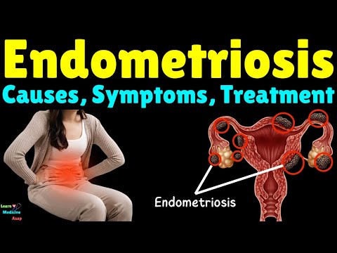 Endometriosis: Causes, Symptoms, Diagnosis, Treatment, Complications & Prevention