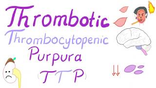 Thrombotic Thrombocytopenic Purpura (TTP)