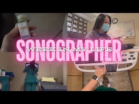 WEEK IN MY LIFE: Registered Diagnostic Medical Sonographer aka ultrasound technologist