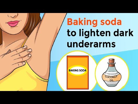 How to Get Rid of Dark Underarms Overnight | Lighten Armpits at Home.