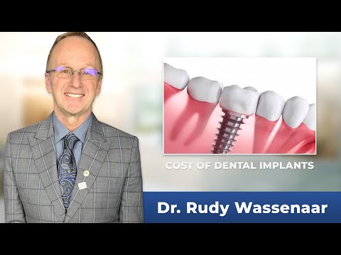 The Cost of Dental Implants with Williams Lake, BC dentist Dr. Rudy Wassenaar