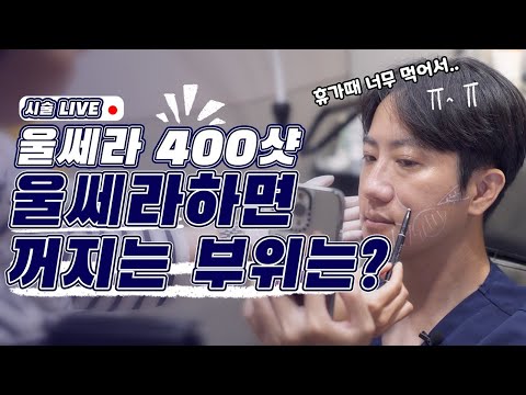 45살 닥터월리도 받는 울쎄라 볼 안 꺼지게 시술 라이브!