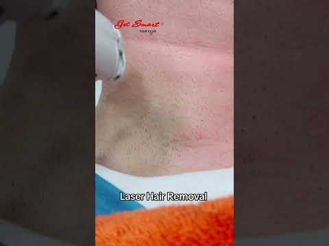 Laser Hair Removal #getsmarthairclub #beauty #viralvideo