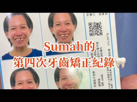 EP123 Sumah牙齒矯正紀錄 第四回合