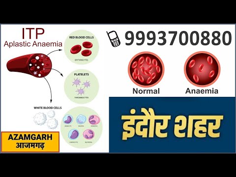 ITP low platelets in children Aplastic Anemia homeopathic treatment dr ak Dwivedi Indore Ayushman