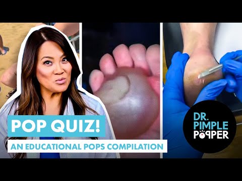 Dr Pimple Popper Pop Quiz! An Educational Pops Compilation