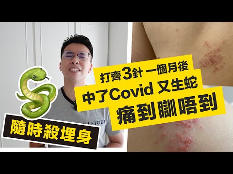 連環不幸事件 😨 打齊三針一個月 😨 就中 Covid 又生蛇 🐍 老婆仲…. 隱形都市病 隨時殺埋身