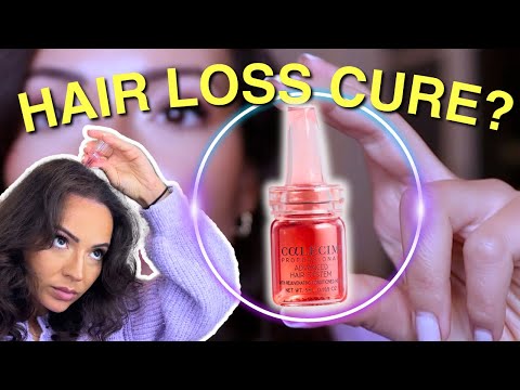 The NEW cure for Hair Loss?! (The Hair Growth Power of Stem Cells with Calecim)