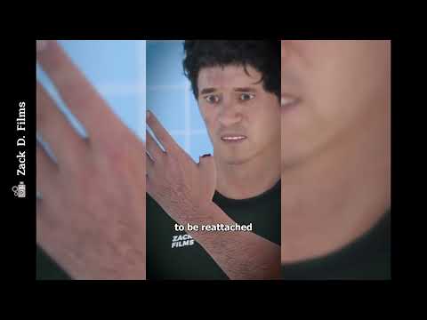 পায়ের বৃদ্ধা আঙ্গুল হাতে সার্জারি - Big Toe Hand Surgery Zack D. Films - Bangla Dubbing