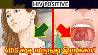 AIDS symptoms in Tamil/AIDS in Tamil/hiv explained in tamil/aids explained tamil/hiv symptoms tamil