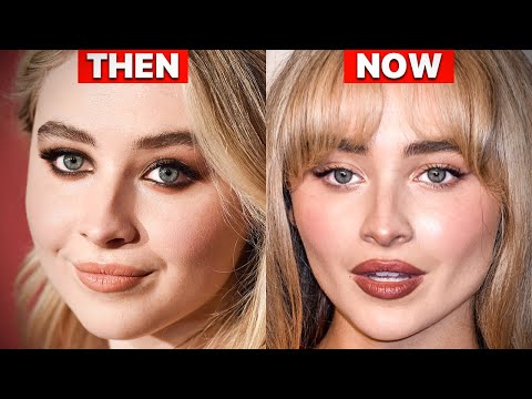 Sabrina Carpenter's NEW Face | Plastic Surgery Analysis