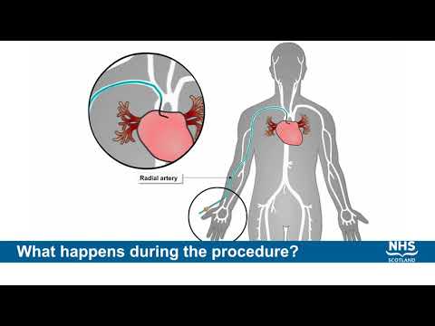 Coronary Angiogram Procedure