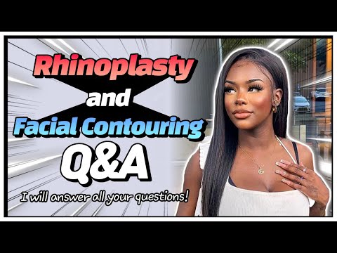 1year after my plastic surgery in Korea! I will answer all your questions! (by Jaylyn)