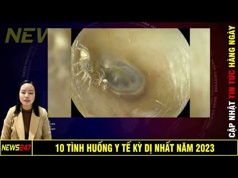 10 Tình Huống Y Tế Kỳ Dị Nhất Năm 2023