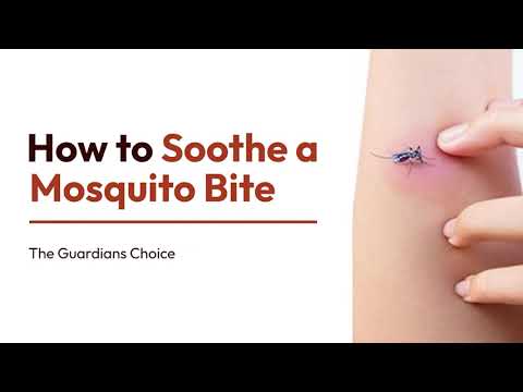 How To Treat and Avoid Mosquito Bites | 4 Ways to Soothe a Mosquito Bite | The Guardians Choice