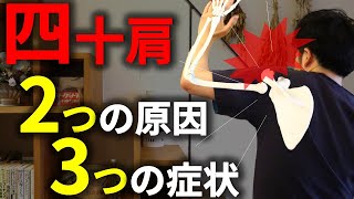 【四十肩】3つの特徴的な症状と2大原因を解説！