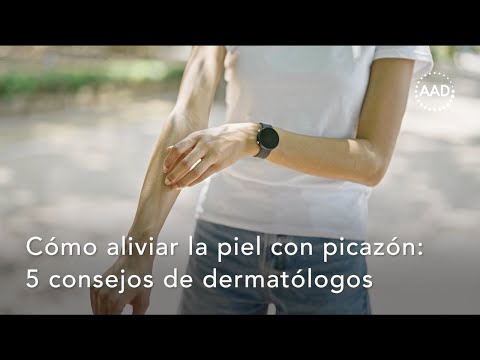 Cómo aliviar la picazón en la piel: 5 consejos del dermatólogo