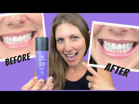 Does Purple Toothpaste Work? SNOW Teeth Brightening Serum Real Results