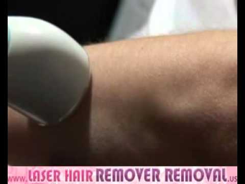 Permanent laser hair removal, Rio Scanning Laser Hair Remover 2/2