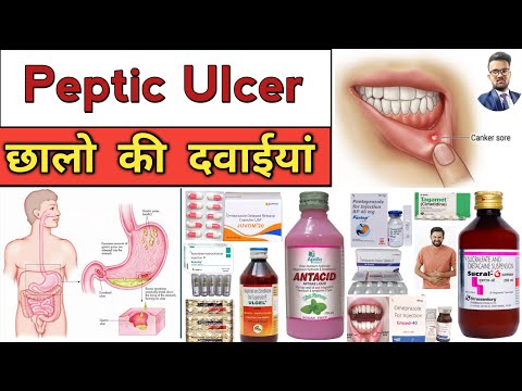 Peptic Ulcer | Gastric Ulcer | Treatment | Medicine | Injection | Pharmacy | Medical | दवाईयां