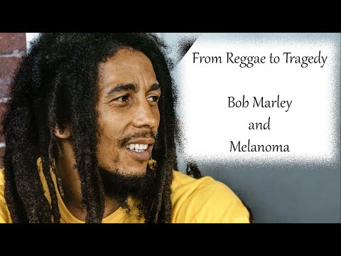 "From Reggae to Tragedy: The Story of Bob Marley's Melanoma"