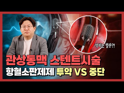 항혈소판제 투약 환자가 수술을 받으려면, 약을 끊어야 하나요?