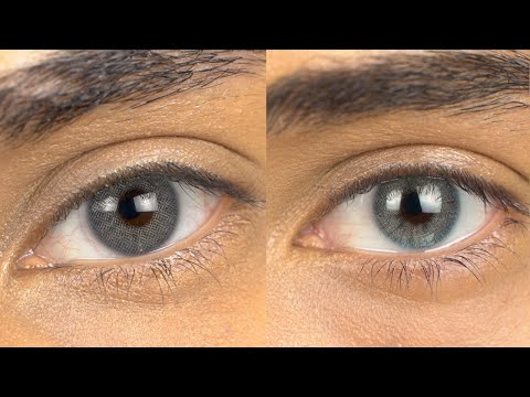 Blue Colored Contact Lenses For Brown Eyes | Solotica Noronha Blue & Anesthetic Mar