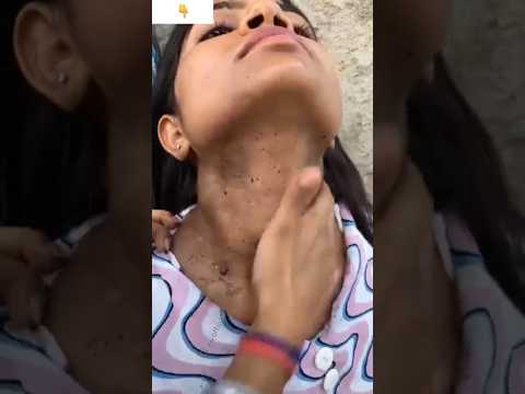 Neck Cleaning Tips | Remove Neck Tanning & Dead Skin Cells,rid Of Dirty Neck #shorts #beautytips