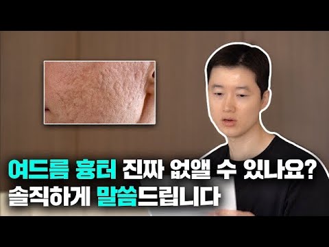 많은 분들이 궁금해 하셨던 여드름, 패인 흉터 치료에 대해 답해드립니다