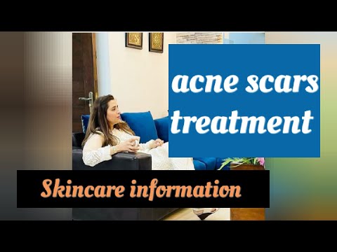 how to get rid of acne scars ! acne scars treatment