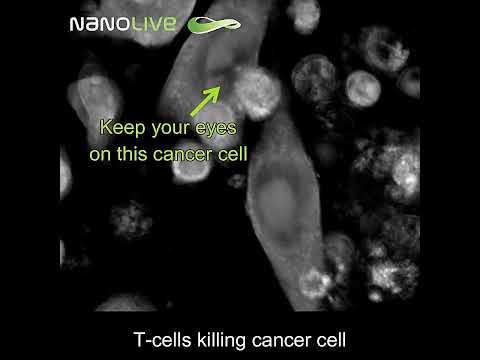 Label-free Live Cell Imaging: T-cells killing cancer cells