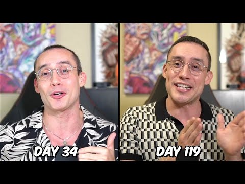 Turkey Hair Transplant Update: 4 Months Later | My Results