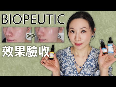 醫美產品1個月後的驗收效果發表 | Biopeutic |  無香精 | 敏感肌評測 | The effect of medical beauty products after 1 month