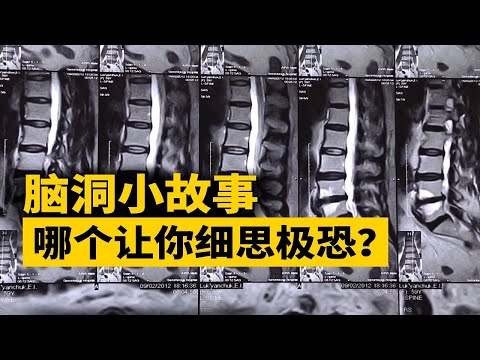 普通人有33塊脊椎骨，而我正在挖她的第168塊……【叮叮貓不咬人】