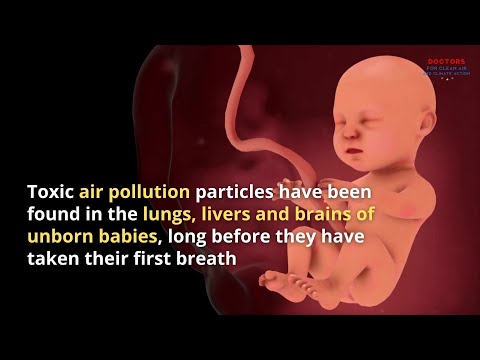 Toxic air pollution particles found in lungs and brains of unborn babies