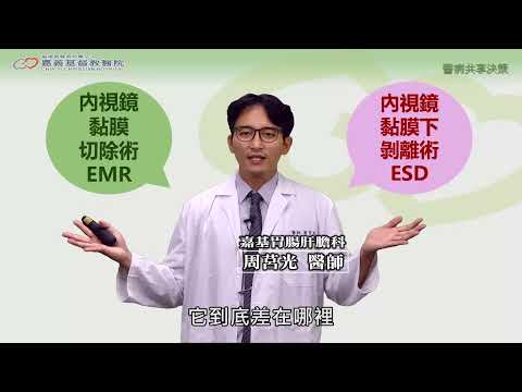 【嘉基】醫病共享決策-SDM：大於兩公分的大腸直腸扁平型良性腫瘤，該選擇什麼治療?