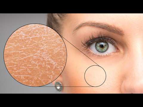 Effective Home Remedies for Dry Skin | Natural Solutions for Soft, Hydrated Skin