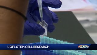 Research study at UofL first in US to treat heart failure with umbilical cord stem cells