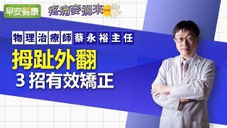 拇趾外翻，3招有效矯正︱蔡永裕主任 【早安健康】