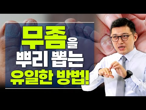 무좀은 왜 자꾸 재발할까? 무좀으로 고생중이라면 꼭 봐야 할 영상!  - 고제익의 비아그라보다 달리기 #39