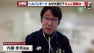 【ヘルパンギーナ】乳幼児に広がるヘルパンギーナ「ワクチンや特効薬はない、かかったら安静に」　家庭内での感染、大人も注意【専門家が解説】 (2023年7月12日)