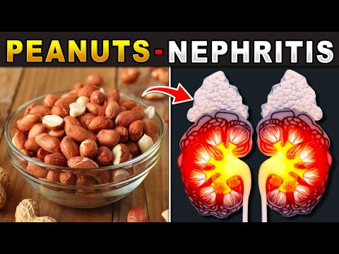 DANGEROUS! PROTECT YOUR KIDNEYS! STOP THIS 5 HARMFUL FOODS IMMEDIATELY! - Healthy Lifestyle