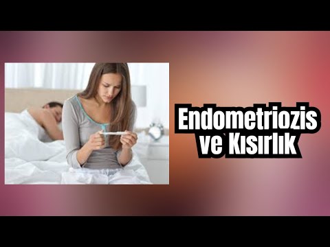 Endometriozis nedir? Endometriozis hastalığında infertilite sorunu