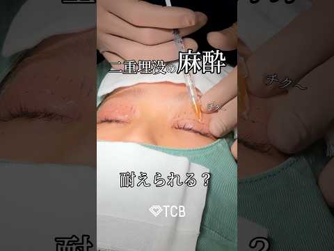 【二重整形】二重埋没の麻酔💉#shorts