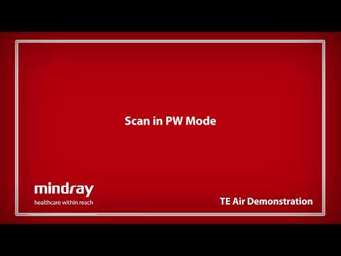 Mindray TE Air Ultrasound Tutorial - Scan in Pulse Wave (PW) Mode