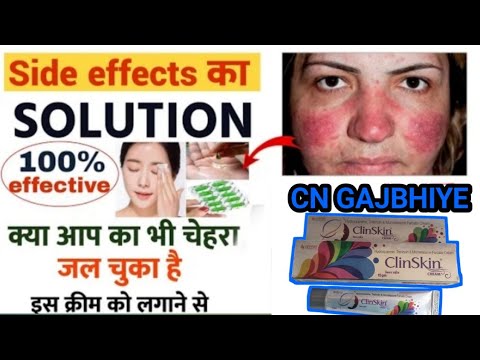 clin skin Cream | Clin skin cream के साइड इफेक्ट को कैसे ठीक करे | cream के side effect solutions